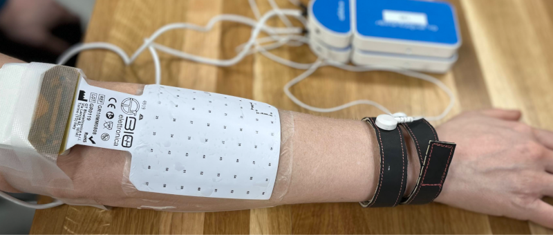 photo of EMG electrodes